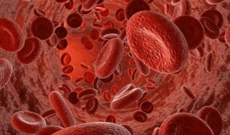 Što je eritremija i kako je to opasno? - Hipertenzija February